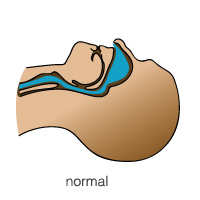 airway-normal