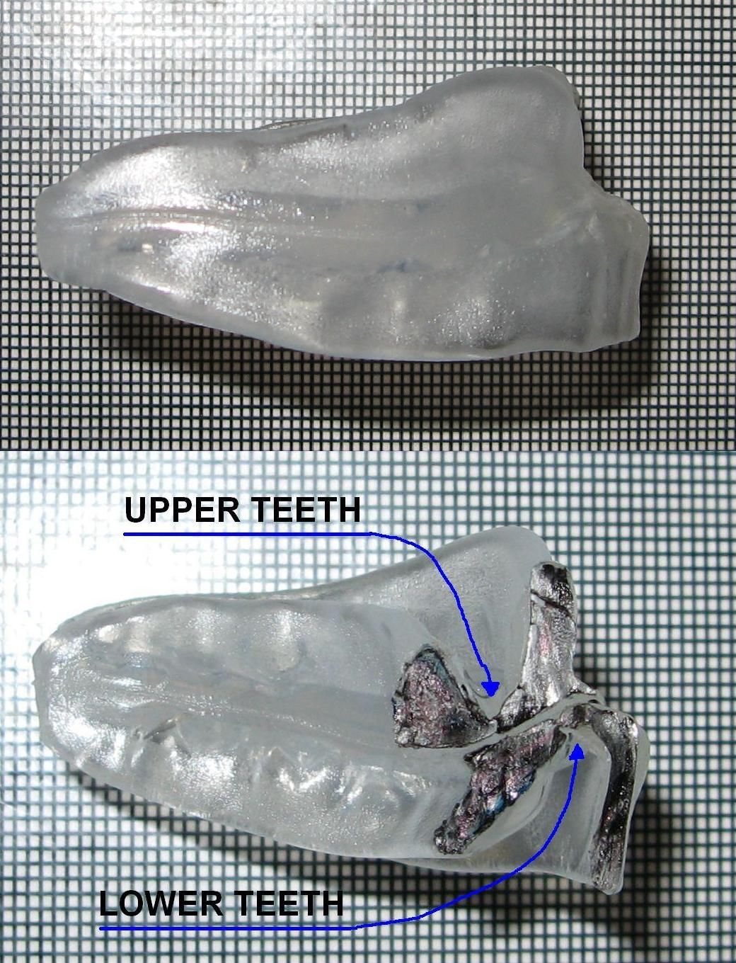 picture of a snorers friend after moulding, including a cross sectional view showing channels for the upper and lower teeth
